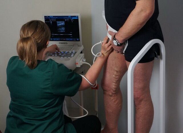 Exame das veas antes da coagulación con láser para varices